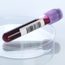 血液検査のイメージ