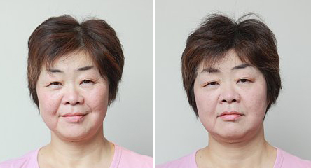 53才オバ記者 あゆ 梨花受けた小顔整体でえら幅 2 5センチ Newsポストセブン