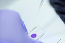 血痕鑑定 超高感度試薬使えば洗濯したシャツからも検出可能