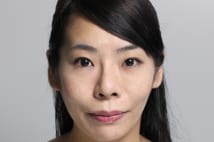 ヒアルロン酸注入のエキスパートが語る「バレない仕上がり」