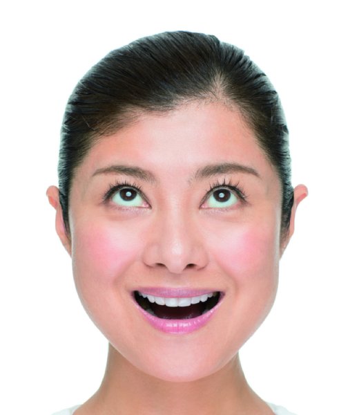 頬のリフトアップしたいなら「キングスマイル」を