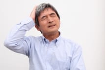 精神科医がアドバイス! ハゲで悩まないメンタルヘルス法