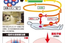 樹木希林、なかにし礼も受けた粒子線治療　費用は300万円