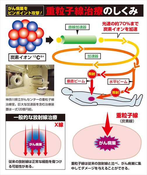 がん病巣をピンポイントで攻撃する重粒子線治療のしくみ