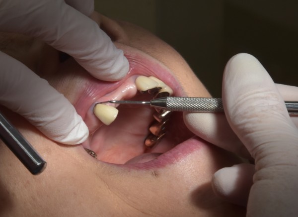 歯茎マッサージ 喫煙 抗生物質 歯周病にまつわる嘘や誤解 News