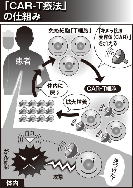 いま最も期待されている最先端治療のひとつ、「CAR-T療法」