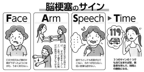 写真 熱中症と脳梗塞 心筋梗塞の違いを見極める Fast とは Newsポストセブン 写真 熱中症と脳梗塞 心筋梗塞の違いを見極める Fast とは Newsポストセブン