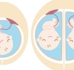 【医師監修】癒着胎盤の診断基準・症状・原因・治療・入院の必要性