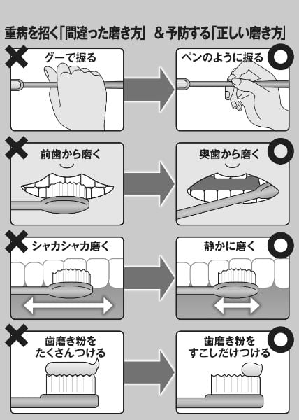 【図解】「間違った磨き方」と「正しい磨き方」を解説