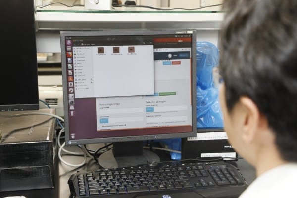 ほくろ部分の画像をAI搭載パソコンに取り込む