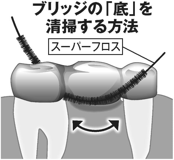 ブリッジの「底」を清掃する方法