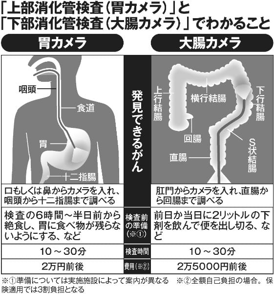 胃カメラと大腸カメラでわかること