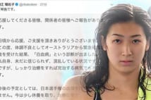 池江璃花子選手が白血病を公表 「信じられず混乱」
