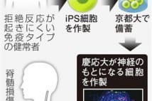 脊髄損傷、慢性患者の治療にも一歩 慶応大のiPS臨床研究