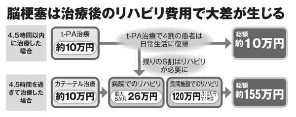 写真 脳梗塞治療の境目は発症4時間半以内 治療費に大差発生 Newsポストセブン Part 2 写真 脳梗塞治療の境目は発症4時間半以内 治療費に大差発生 Newsポストセブン Part 2