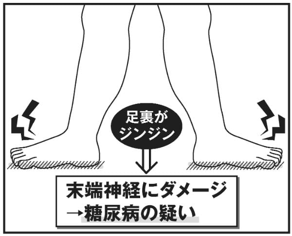 末端神経にダメージ→糖尿病の疑い