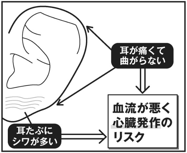 耳たぶで健康チェック