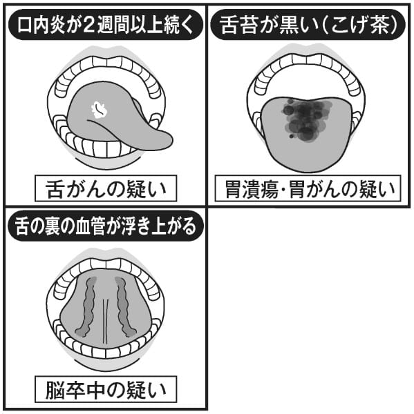 舌は情報の宝庫