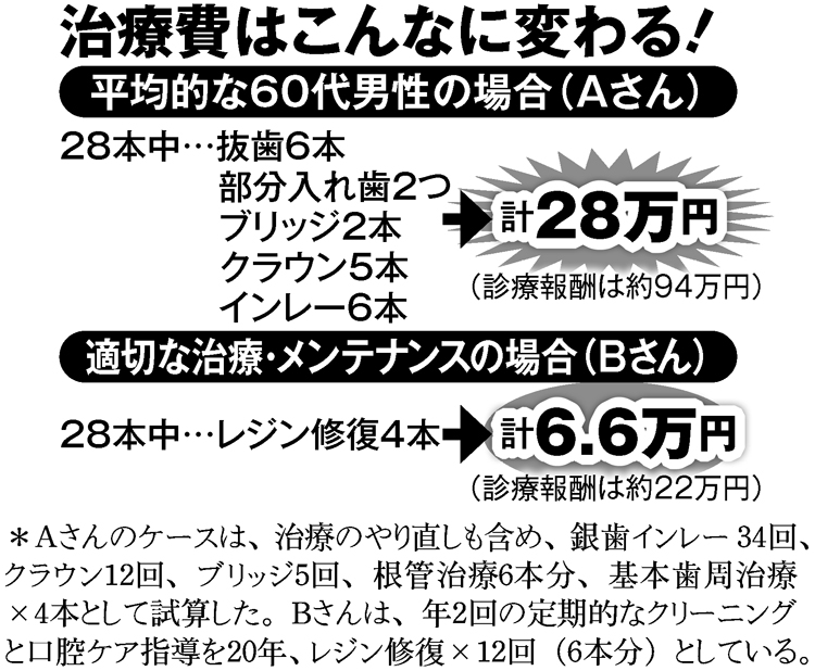 治療費はこんなに変わる