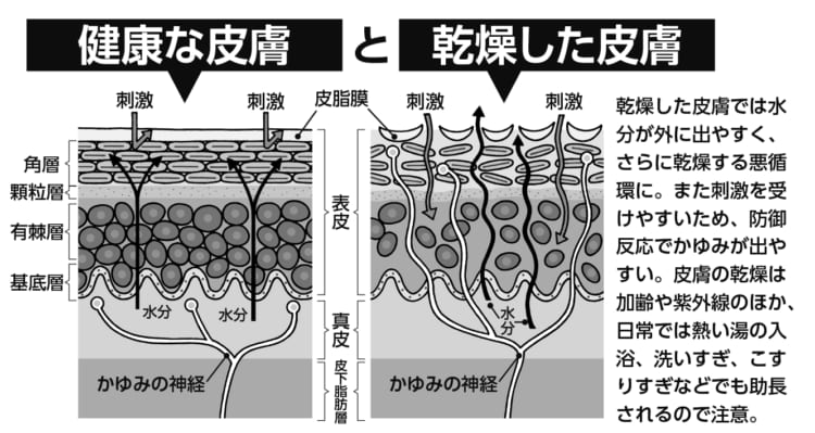 健康な皮膚と乾燥した皮膚　違いを図解（イラスト／オモチャ）