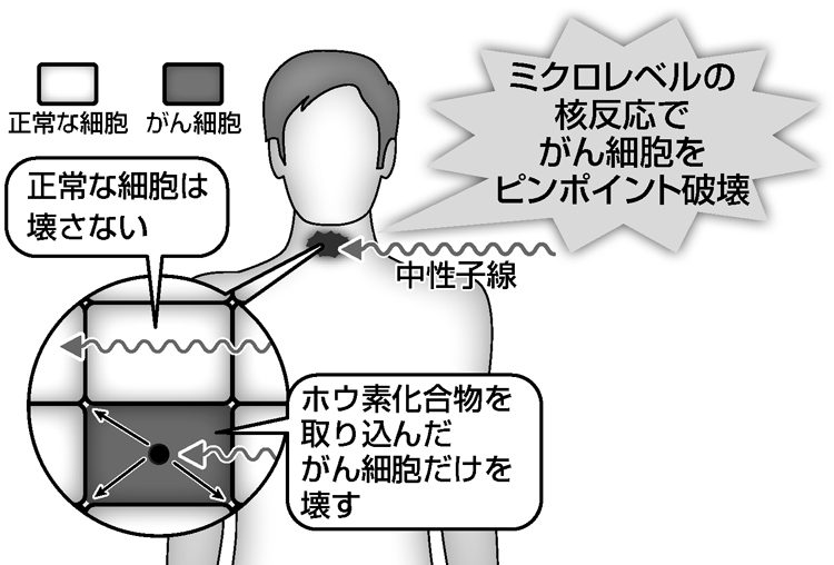 注目の「ホウ素中性子捕捉療法」