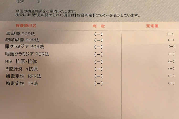 Hiv セクシー 女優