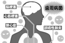 歯周病は万病のもと