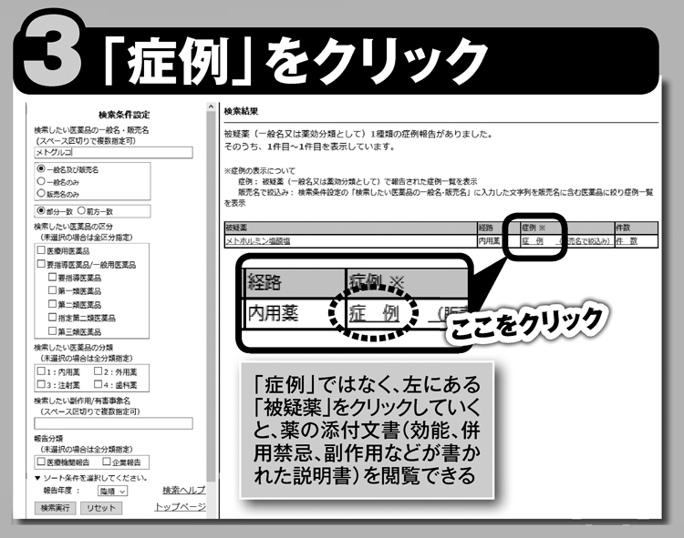 「症例」をクリック