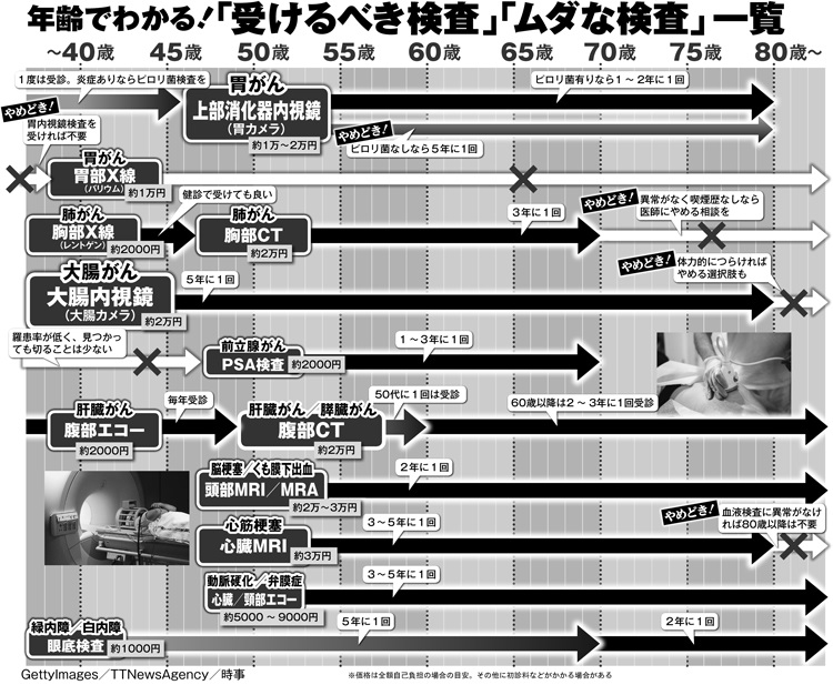 年齢別「受けるべき検査」「ムダな検査」