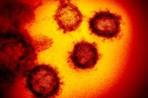 新型コロナウイルス「SARS-CoV-2」の電子顕微鏡画像（AFP=時事）