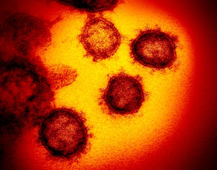 新型コロナウイルス「SARS-CoV-2」の電子顕微鏡画像（AFP=時事）