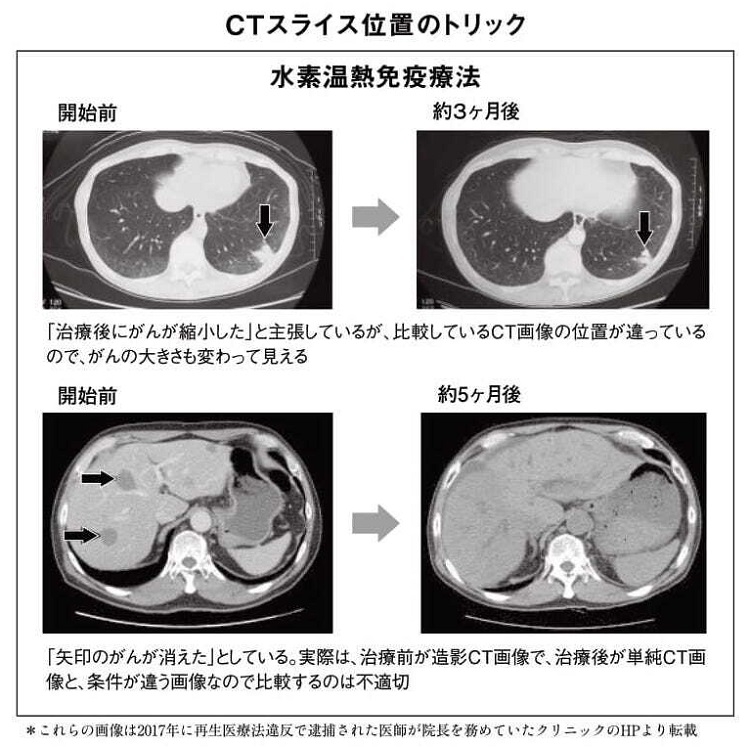 CT画像を使う際に“位置”や“CTの種類”を駆使したトリックが行われることも