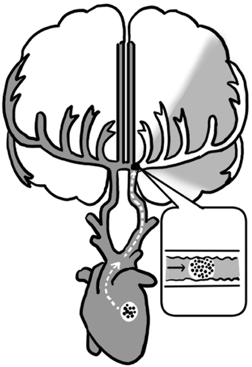 不整脈がある人に多い