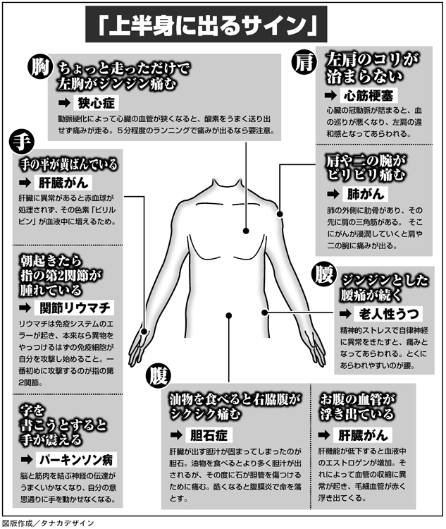 上半身に出る体調不良のサイン