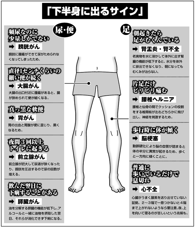 下半身に出る体調不良のサイン