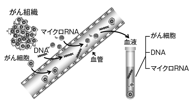 体液（血液）を分離し、がん細胞から出たマイクロRNAだけを取り出して検査する