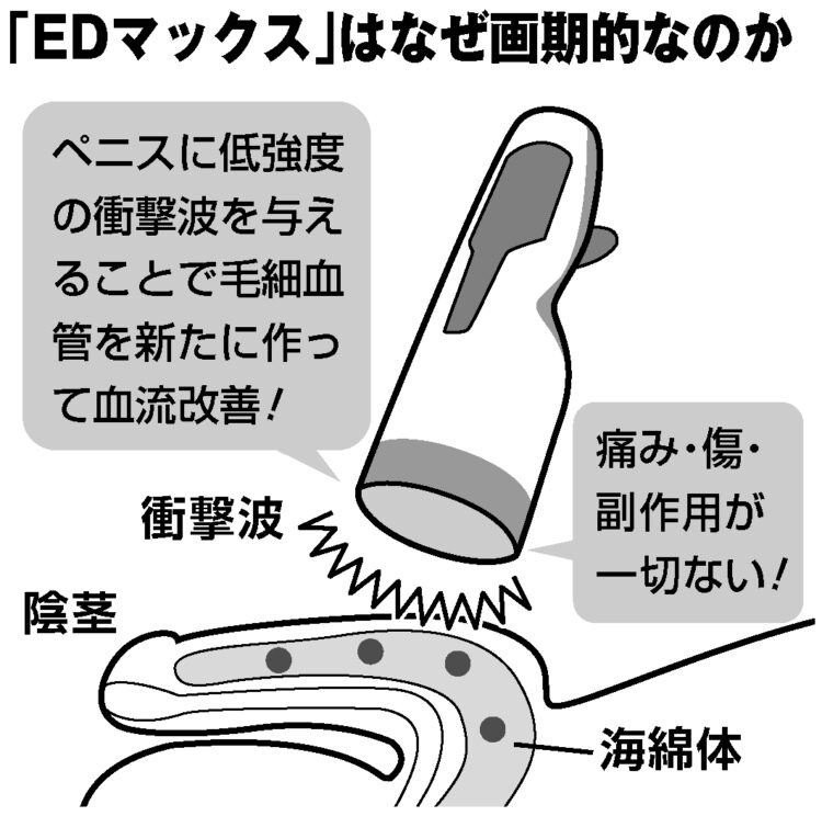 写真 3500発の衝撃波を当てるed治療機 体験者が実感する効果 Newsポストセブン
