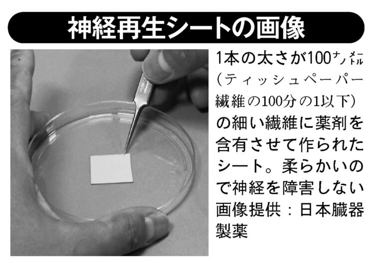 神経再生シートの画像