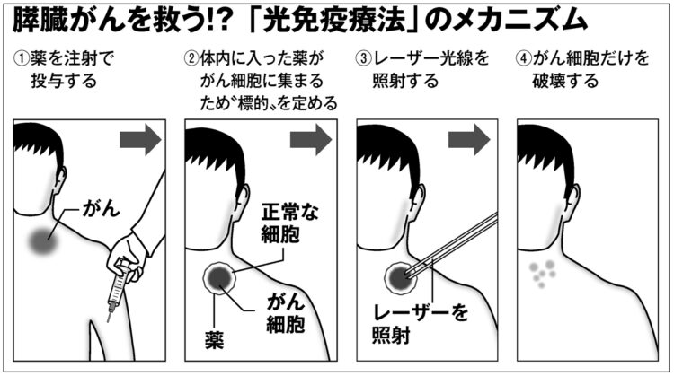 「光免疫療法」のメカニズム