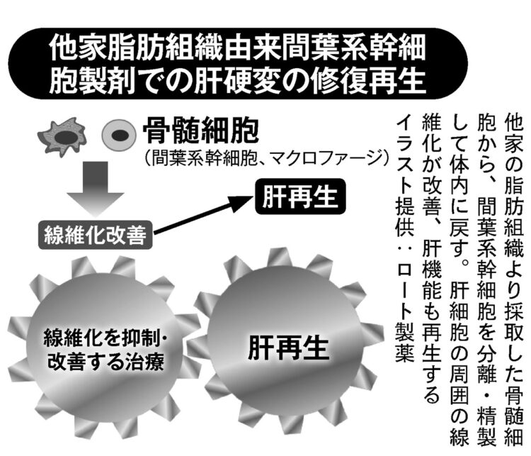 「肝硬変の修復再生」のイメージ