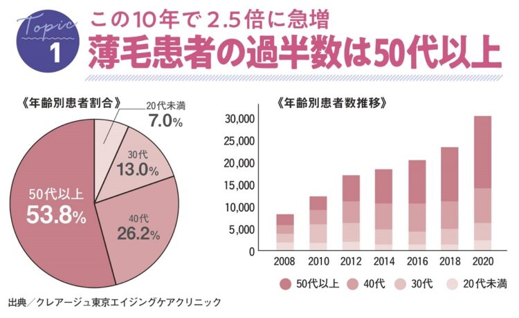 女性の薄毛患者は年々増加