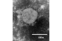 コロナ変異株は怖いのか　「弱毒だから広がる」という指摘も