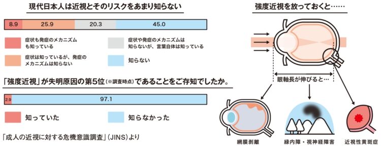 近視・老眼の病的リスク