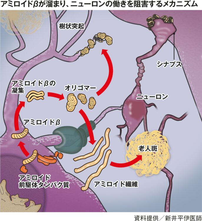 ニューロンの働きを阻害するメカニズム