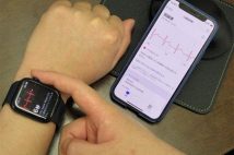 【画期的!アップルウォッチで心臓病予防】心電図はいつ記録するのか タイミングを誤っては診断につながらない