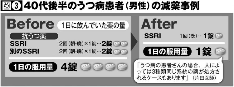 40代後半のうつ病患者（男性）の減薬事例