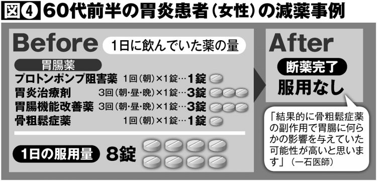 60代前半の胃腸炎患者（女性）の減薬事例