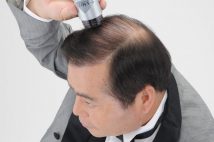 スーパーミリオンヘアー・阿部社長 自ら出演するCMは「韓国から逆輸入」