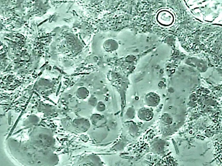 口腔内には約700種の「常在菌」が存在