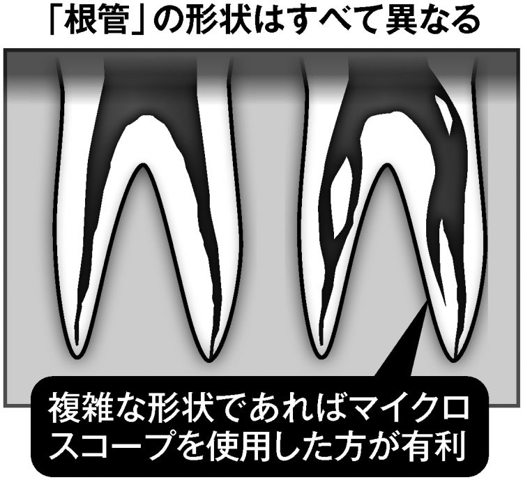「根幹」の形状はすべて異なる